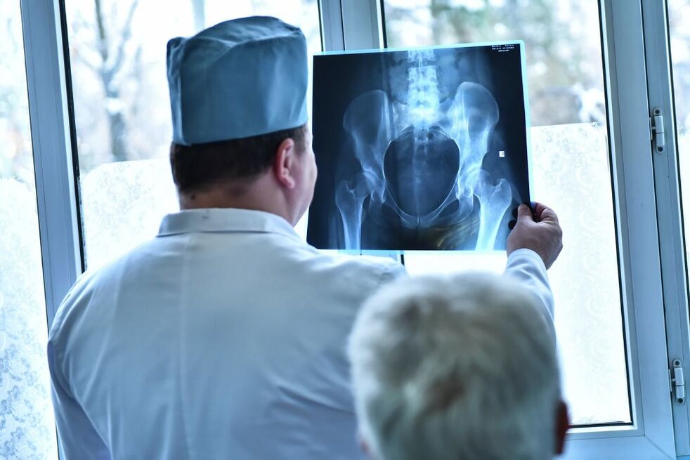 Dọkịta ahụ na-elele foto nke nkwonkwo hip nwere arthrosis